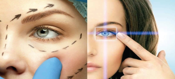 PLASTICAOCULAR