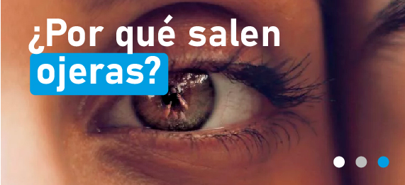 por que salen las ojeras