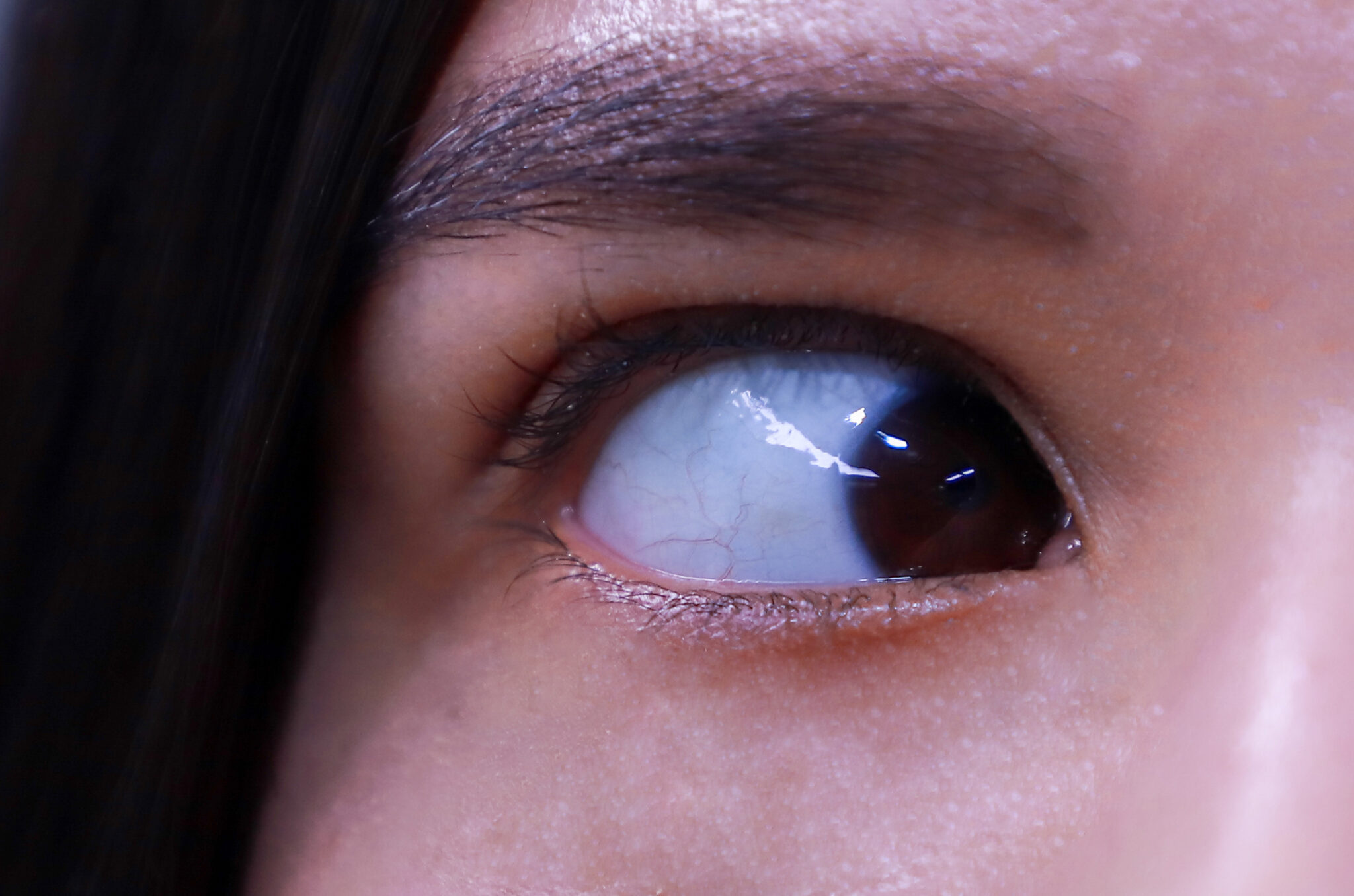 OJO MARICAMI SIN OJERA scaled