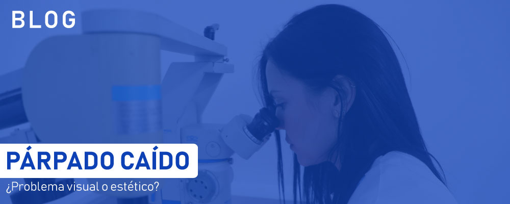 PÁRPADO CAÍDO