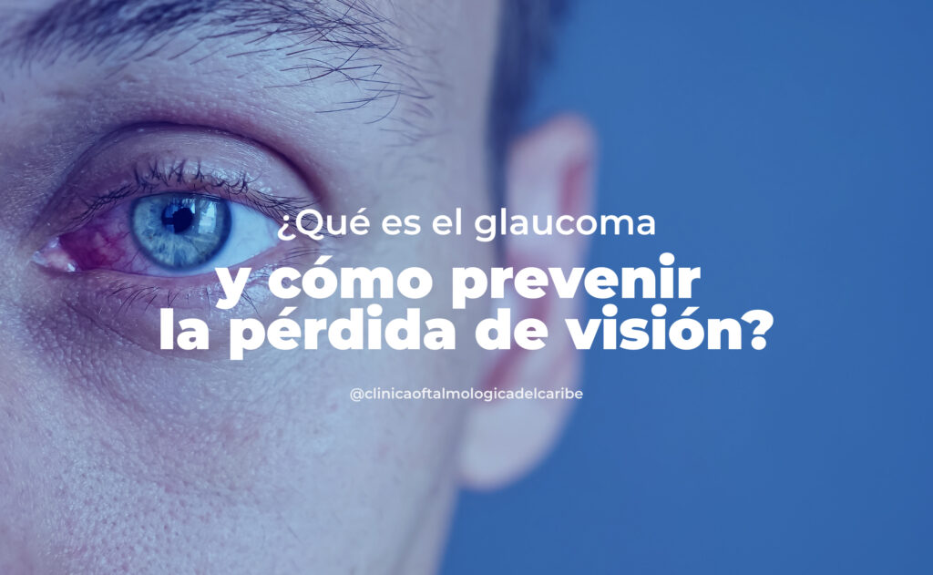 Glaucoma: detección temprana con exámenes regulares, control de presión ocular, dieta antioxidante, ejercicio, protección solar y evitar el tabaco